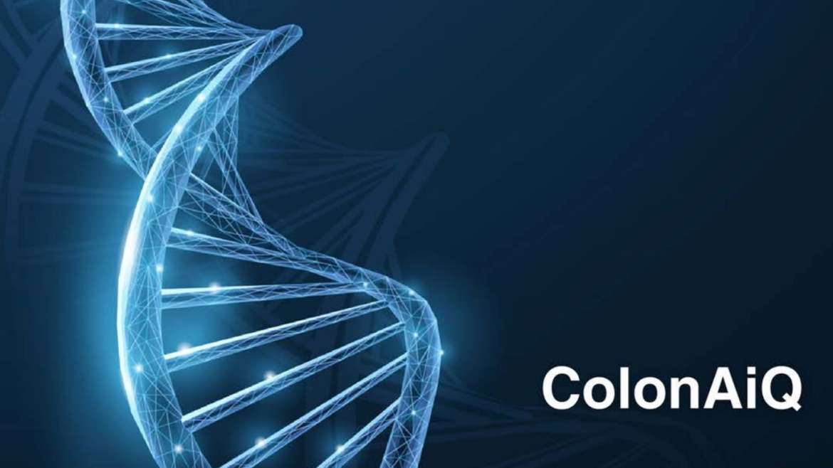 ColonAIQ – Költséghatékony és gyors vastagbél daganat-szűrés molekuláris teszttel
